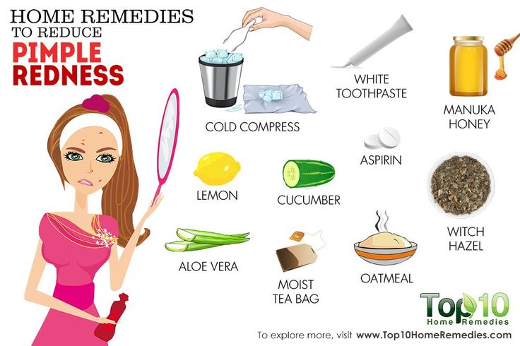 Home Remedies and Self-care Tips
